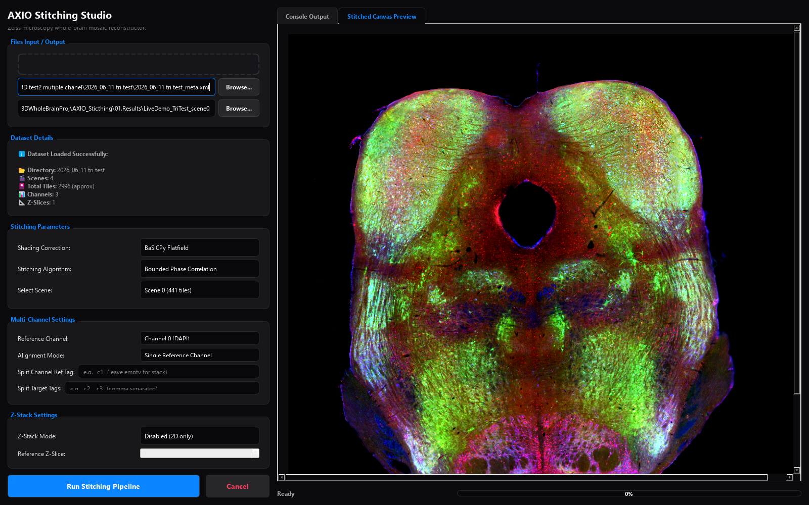AXIO Stitching Studio dark-themed window showing a stitched triple-fluorescence brainstem section — DAPI blue, FITC green, Rhodamine red — in the Stitched Canvas Preview tab; dataset details read 4 scenes, 2,996 tiles, 3 channels, with BaSiCPy flatfield and bounded phase correlation selected